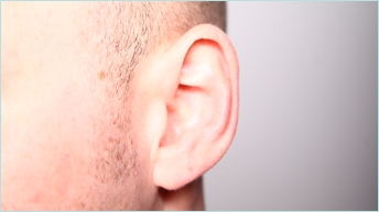 Chirurgie des oreilles (Otoplastie)